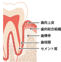 歯周病ってどんな病気？