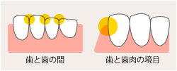 PMTCは自分ではできない