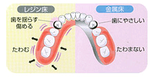 金属床